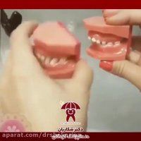 عوارض مکیدن پستانک و انگشت در کودکان