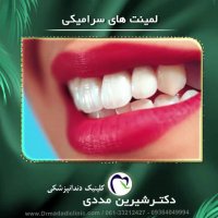 فیلم لمینیت سرامیکی دندان