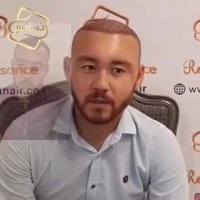 تکنیک سوپر کاشت کلینیک رنسانس- 02122088210