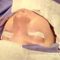 فیلم جراحی بینی فانتزی