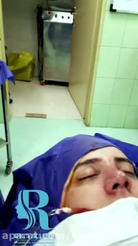 جراحی زیبایی بینی گوشتی
