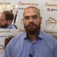 کاشت مو کلینیک تخصصی رنسانس