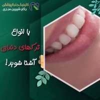 انواع ترک‌های دندانی