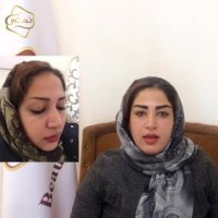 فیلم کاشت ابرو -کلینیک تخصصی رنسانس