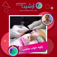 عمل کاشت ابرو