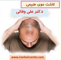 شستشوی سر بعد از کاشت مو