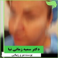 کاشت ابرو طبیعی چگونه می باشد؟