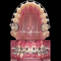 متخصص ارتودنسی | دکتر داودیان