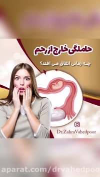 حاملگی خارج از رحم