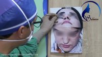 فیلم بسیار جالب از جراحی بینی با شکاف لب