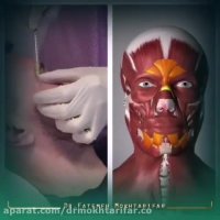 مراقبت های بعد از تزریق بوتاکس چیست؟