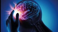 همه چیز درباره بیماری صرع