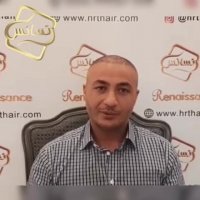 کاشت مو رنسانس - کلینیک تخصصی رنسانس
