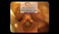 مجهزترین مرکز تخصصی درمان حنجره  در البرز 09121623463