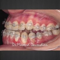 ارتودنتیست تهران | دکتر داودیان