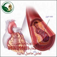 درمان گرفتگی عروق کرونر در تیم تحقیقاتی فردوسی