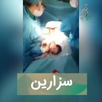 سزارین نوزاد