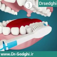 مسواک زدن نادرست