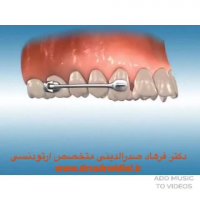 متخصص ارتودنسی