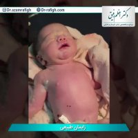 فیلم زایمان طبیعی