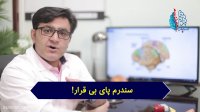سندرم پای بی قرار