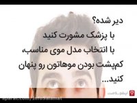 راهکارهایی برای فرار از کچل شدن!