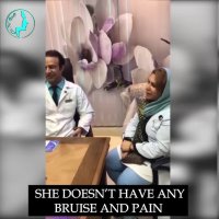 دو هفته بعد از عمل زیبایی بینی | دکتر گلی