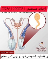 درمان قطعی بیماری خطرناک واریکوسل