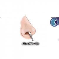 انیمیشنی از جراحی رینوپلاستی