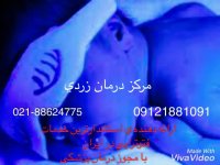 اجاره دستگاه فتوتراپی (زردی نوزاد ) با مجوز رسمی