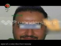 سیر کاشت مو