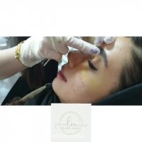 عمل بینی پهن