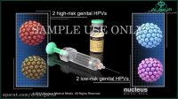 در مورد HPV چه می دانید؟