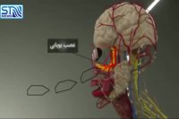 تاثیر آلودگی هوا بر مغز کودکان