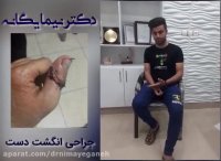 جراحی دست توسط دکتر نیما یگانه