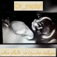 حرکات جنین در داخل شکم مادر