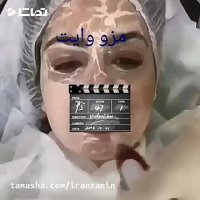 آموزش میکرونیدلینگ آموزش مزووایت آموزش مزونیدلینگ موسسه ایران زمین