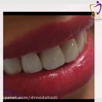بهترین دندانپزشک زیبایی در تهران