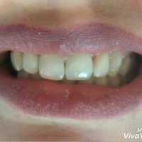 فیلم اصلاح طرح لبخند