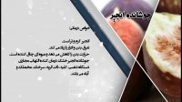 خواص غذایی و درمانی جوشانده انجیر-دانش تغذیه