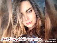 جراحی زیبایی بینی