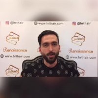 فیلم کاشت مو-کلینیک تخصصی رنسانس